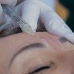 Botox Treatment – Here’s What You Need To Know About It