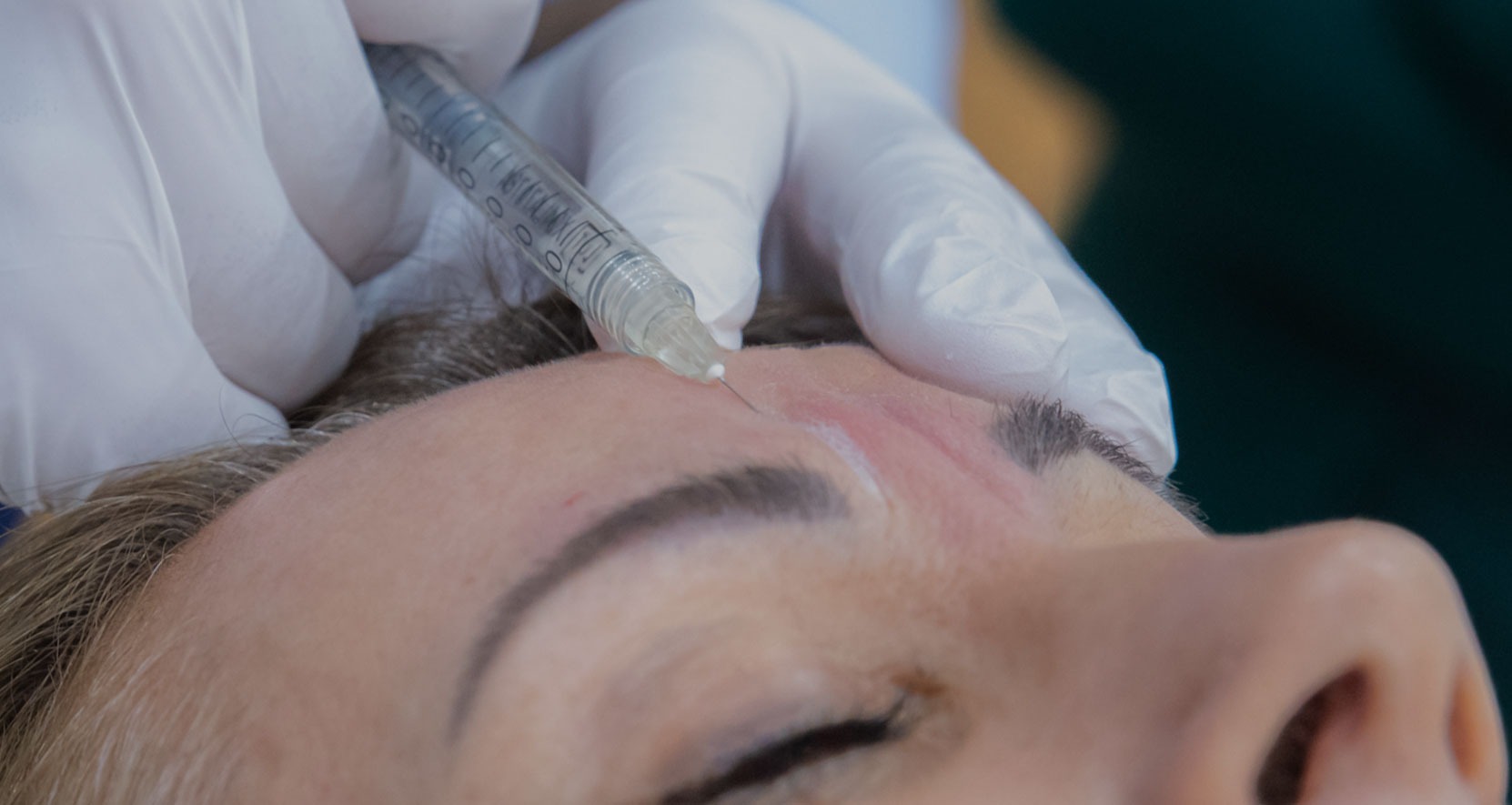Botox Treatment – Here’s What You Need To Know About It